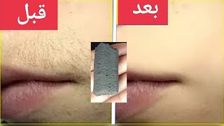 حبة جبارة أقوي من الليزر  تزيل شعر الوجه والجسم والمناطق الحساسة سيسقط الشعر لوحده بدون ألم نهائيآ