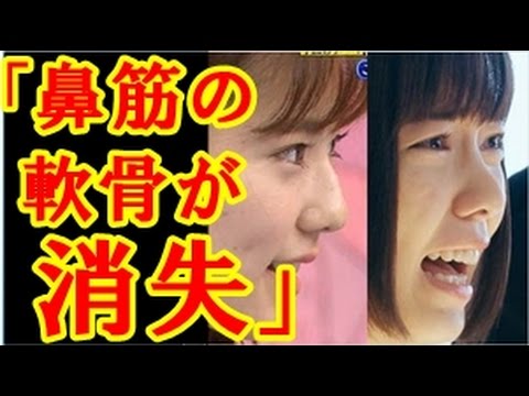 衝撃 ぱるること元akb48島崎遥香の鼻が現在やばすぎる 整形疑惑浮上 Youtube 衝撃 ぱるること元akb48島崎遥香の鼻が現在やばすぎる 整形疑惑浮上 Youtube