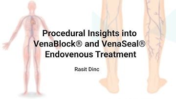 Procedural Insights into VenaBlock® and VenaSeal® Endovenous Treatment | Rasit Dinc