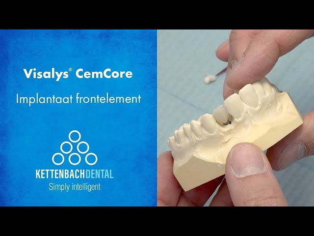 Visalys® CemCore als cementeercomposiet bij Implantologie