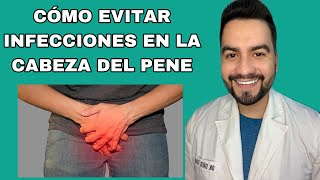 COMO EVITAR INFECCIONES EN EL GLANDE / INFECCIONES EN LA CABEZA DEL PENE |  DR. DAVID CAMPOS - YouTube