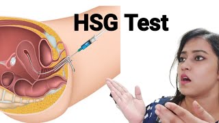 HSG Test | HSG Test Pain | My Experience @helpbyreetu