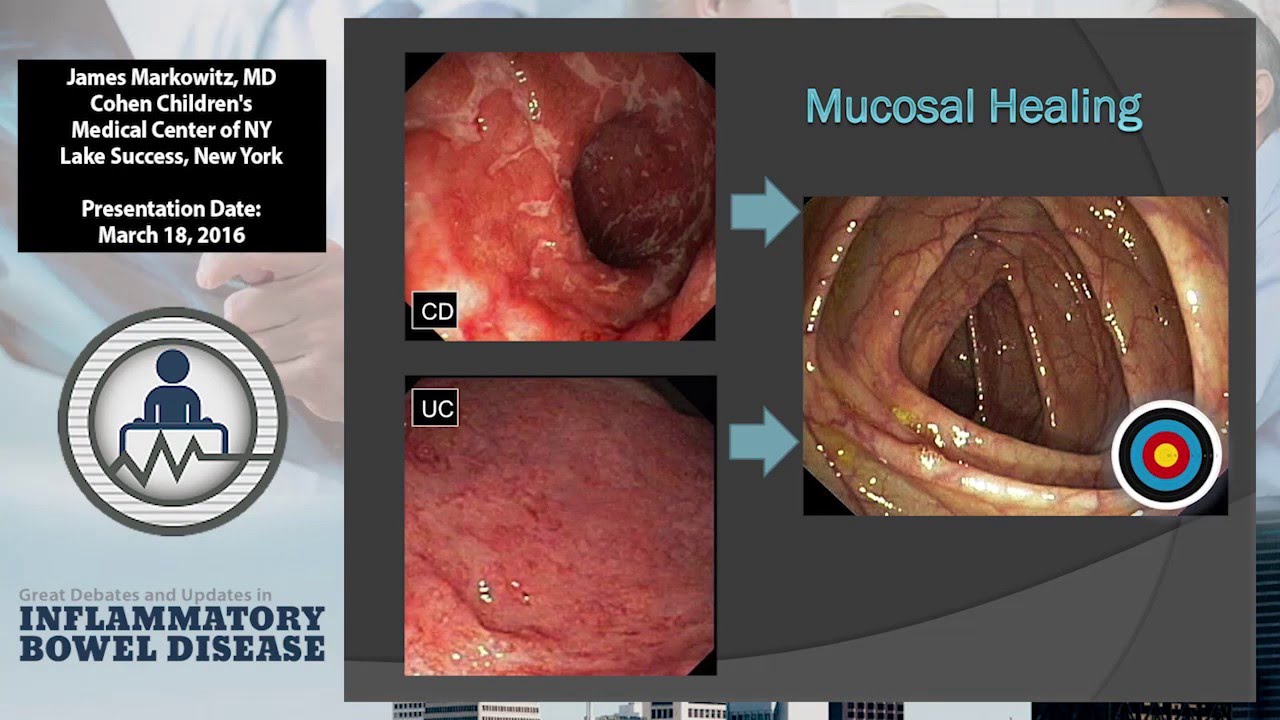 Picking a Treatment Target: Is it as