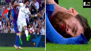 Leo Messi Bleeding By Marcelo A Bad Day Of Lionel Messi Life