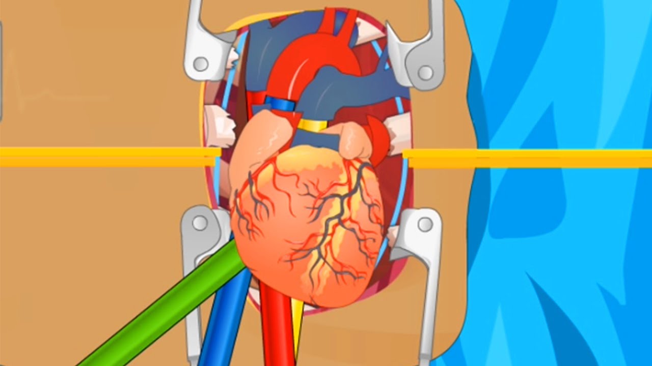 CIRURGIA NO CORAÇÃO - OPERATE NOW 