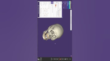 Canine Guidance with exocad articulator