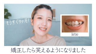 【歯列矯正#7】もうすぐ9ヶ月！歯並びが変わったら笑顔が変わりました【抜歯あり表側ワイヤー矯正】