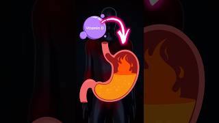 Could your Acid Reflux be a Vitamin D problem? #gerd