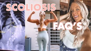 SCOLIOSIS FAQ&#39;S / PREGNANCY, WORKING OUT, MY STORY!