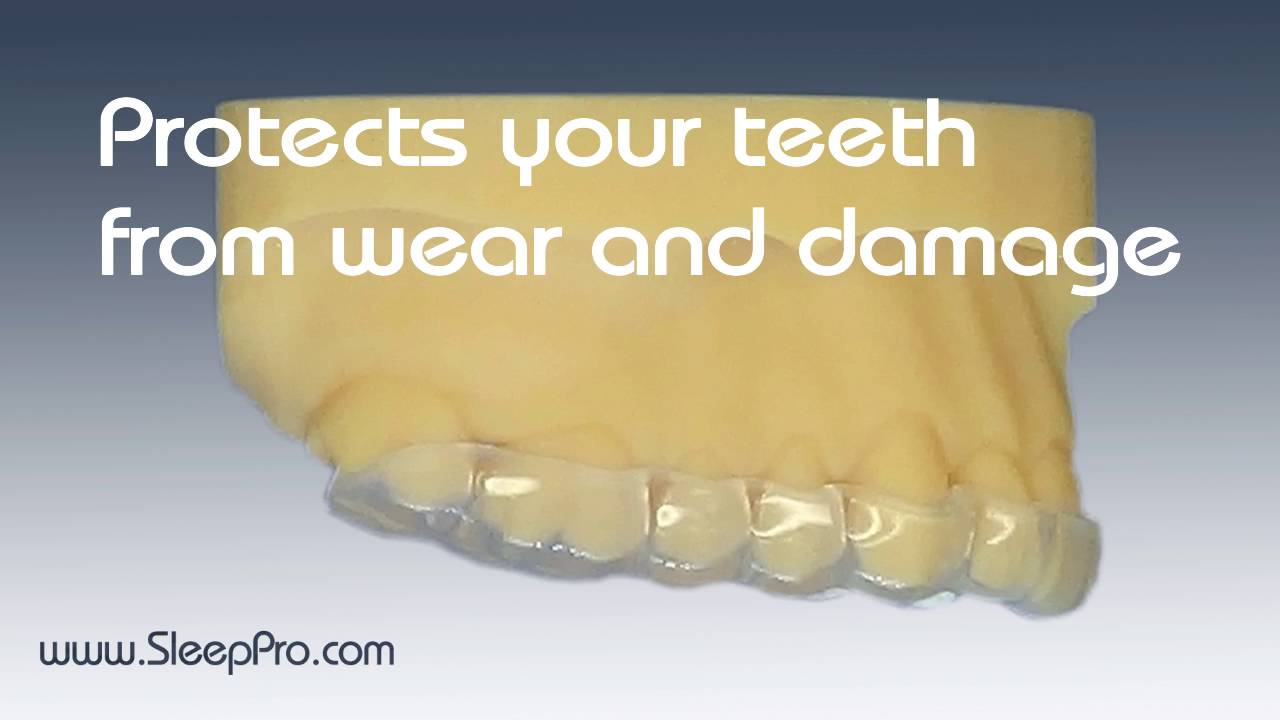 SleepPro Standard Night Guard