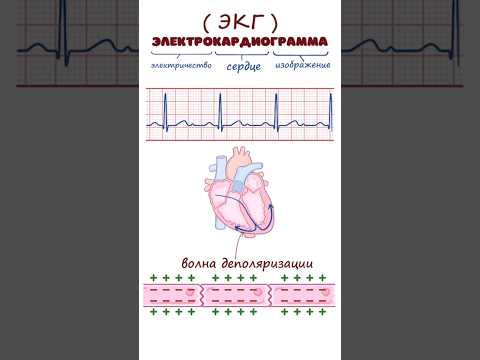 ЭКГ основы