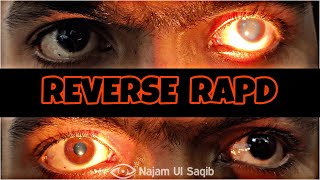 Reverse RelativeAfferentPupillary Defect(RAPD)In Traumatic Optic Neuropathy-The Swinging light test