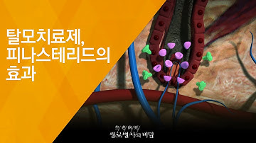 탈모치료제, 피나스테리드의 효과 - (20180801_657회 방송) 毛자람에 대하여