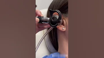How An ENT Doctor Removes Ear Wax 