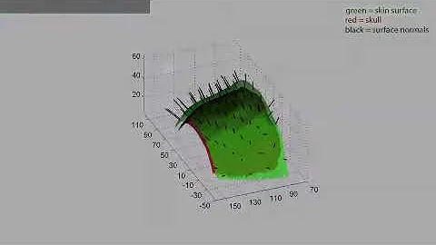 An approach to improve accuracy of optical trackin...