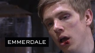 Emmerdale - Cain Tortures Robert