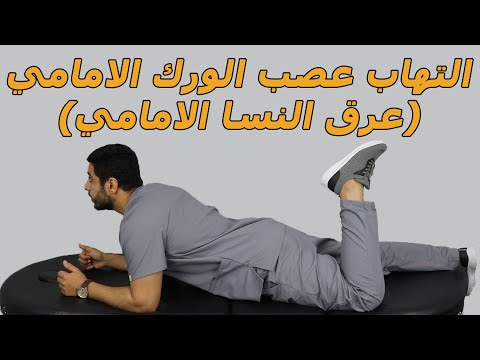بخطوه واحده بس تخلص من التهاب عصب الورك الامامي أهم تمرين لعلاج الم وتنميل وشد الورك والحوض والركبه