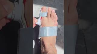 Adjustable Toe Corrector Support Tool #tools #gadgets #utility #shorts