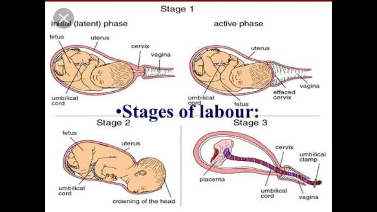 Stages of Labour - YouTube