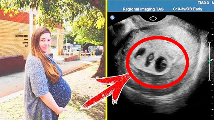 The doctors did an ultrasound and were numb! They have never seen anything like this in their lives!