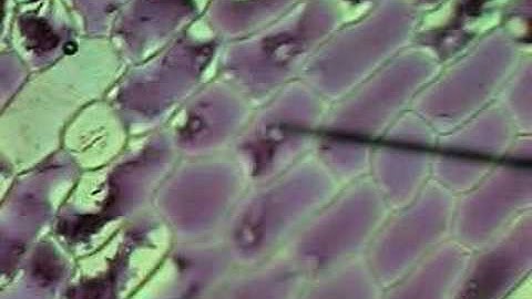 Onion Cells Plasmolysis