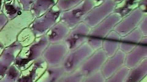 Onion Cells Plasmolysis