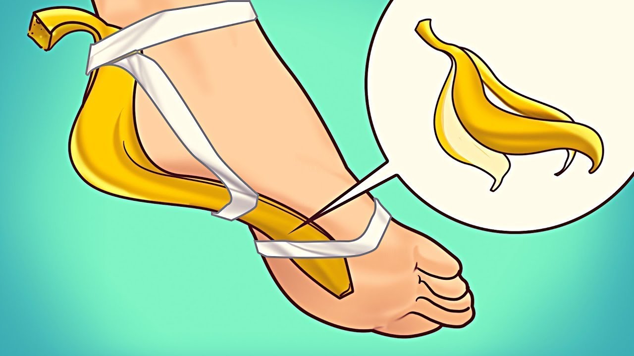 Привяжите Банановую Кожуру на 7 Дней и Посмотрите, Что Произойдет с Вашим Организмом
