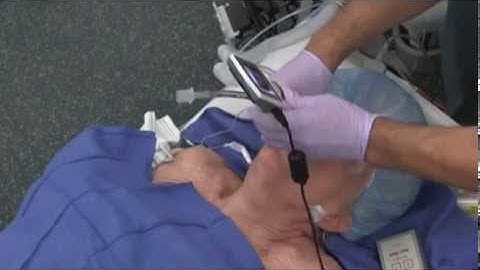 KingVision aBlade from AOD