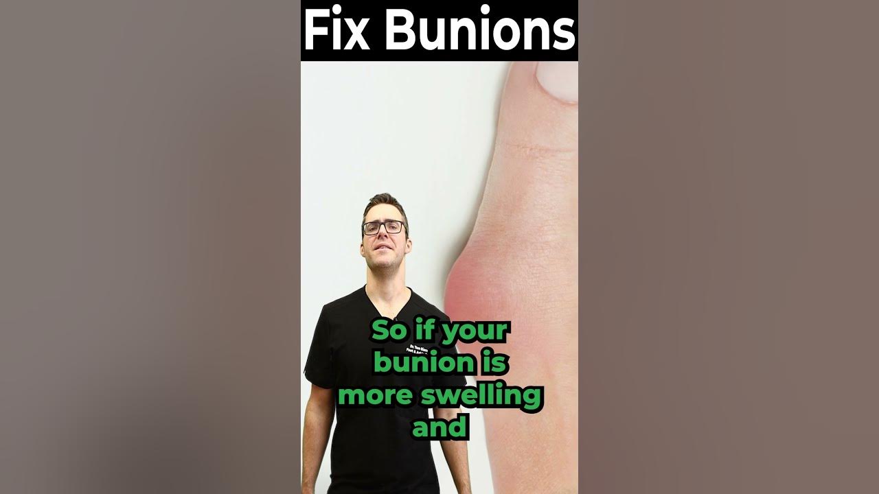Bunion Pain Relief with Medication? [NSAIDs, Steroids & Creams] YouTube