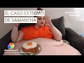 Pesar 426 kilos: así es la vida de Samantha, uno de los casos más extremos | Mi vida con 300 kilos