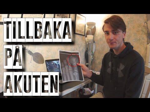 Video: Brutna ärmsymptom, Diagnos, Behandling Och Vård