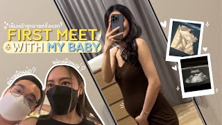 First meet baby👶🏻🤍อัลตร้าซาวน์เห็นหน้าลูกครั้งแรก ,ตรวจเบาหวานตั้งครรภ์ ,รีโนเวทห้องลูก🐰|Jenniechira