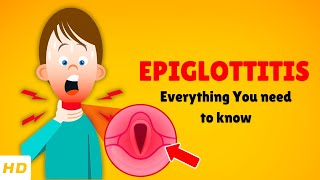 Epiglotis Causes, Signs And Symptoms, Diagnosis & Treatment