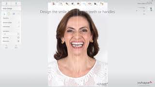 3Shape 스마일 디자인 - 스마일 디자인 사용자 인터페이스 - 3Shape Smile Design - 3Shape Smile Design Use Interface