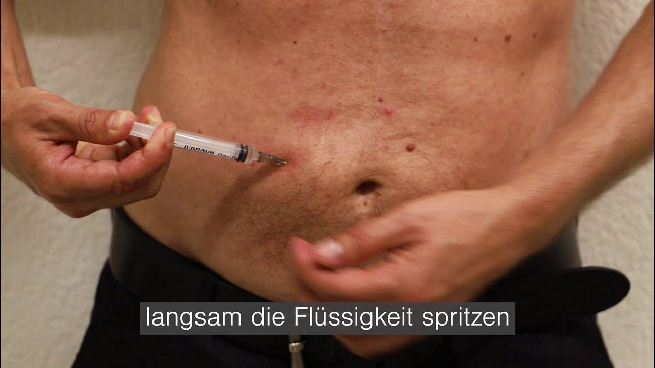 Lernvideo die subkutane Injektion von Testosteron für Transmänner YouTube