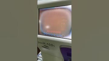 CBC Complete Blood Count #laboratory #mls #medtechstudent #cls #EDTA