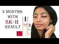 SK-II Honest Review / 3 Month result SKIN UPDATE