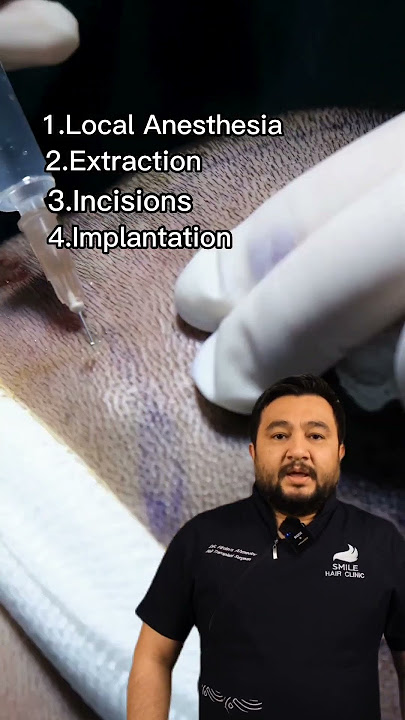 HAIR TRANSPLANT SURGERY STEPS - HOW IS FUE APPLIED?