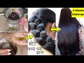 Winter Thick Dense -Hair Growth-Oil-Apply Just for 4 Weeks-For Double Growth &amp; Volume- Zero HairFall