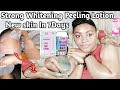 STRONG WHHITENING PEELING LOTION FOR REMOVING DARK SKIN AREAS & EVEN SKIN FROM HEAD TO TOE/In7 Days