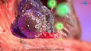 Tumor (cancer) immune response MoA animation