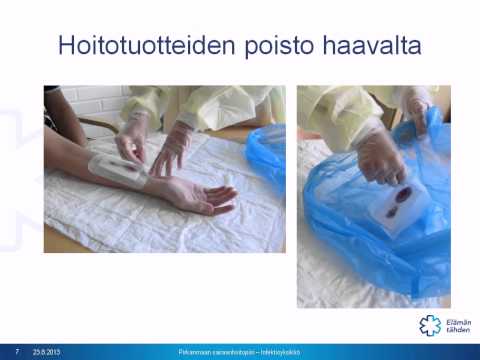 Video: Reiden Kiillotus: Syyt, Hoidot Ja Ehkäisy