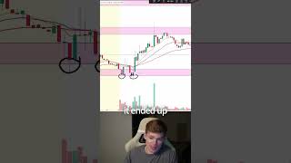 Overtrading is a discipline problem, not a strategy problem Every trade I take runs through the