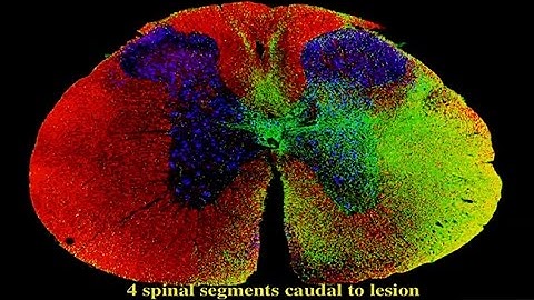 Personalized Medicine for Rodents: What the Genomics Era can Teach Us in the Quest for Therapeutics