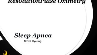 Understanding High Resolution Pulse Oximetry