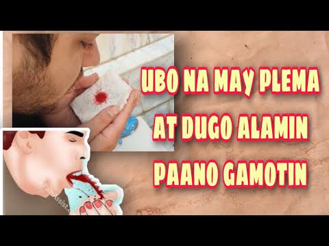 Video: Malalaman natin kung ano ang dapat kainin na may mababang hemoglobin: isang listahan ng mga pagkain, mga panuntunan sa malusog na pagkain, prutas, gulay, butil at payo mula sa mga 