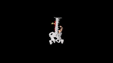 3D CT Reconstruction Based on Deep Learning