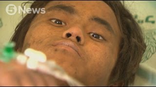 15-year-old boy pulled from rubble 5 days after earthquake