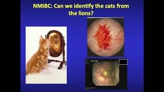 06 BCG Failure in high grade NMIBC what next Prof A Zlotta