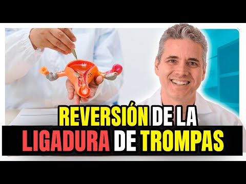 Vídeo: Reversión De La Ligadura De Trompas: Costo, Tasas De éxito, Procedimiento Y Más